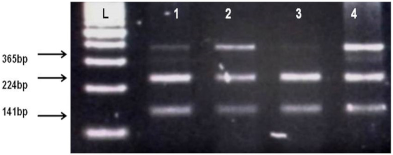 Identification of AChE rs17228602 polymorphism. L, DNA ladder, 1, 2, 4 show TC heterozygotes (Cleaved fragments 224 bp, 141 bp and uncleaved PCR products 365 bp), 3 shows CC homozygote (Cleaved PCR product into 224 bp and 141 bp fragments).