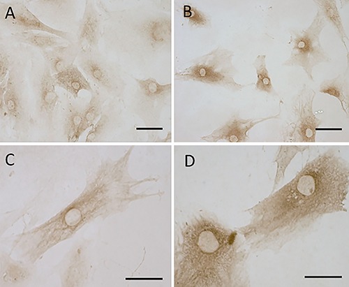 CB1 and CB2 receptor gene expression in human fascial fibroblasts: CB1 (A,C) and CB2 (B,D). Scale bars: 50 µm.