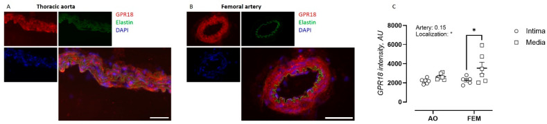 GPR18 expression in the arterial wall of the thoracic aorta (AO) and femoral artery (FEM). Immunofluorescent staining for GPR18 (red), autofluorescent elastin signal (green), and DAPI nuclear staining (blue) for the thoracic aorta (A) and femoral artery (B) of GPR18 WT mice and their quantification within the medial and intimal layer (C). Scale bars represent 50 µm. Statistical analysis using two-way ANOVA. * p < 0.05.