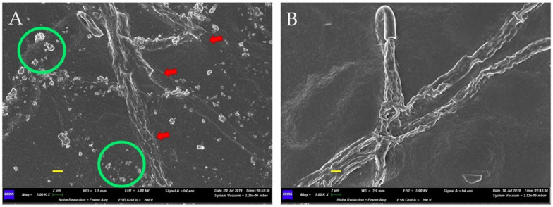 Scanning Electron Microscope (SEM) micrographs at 5000 X that show the abnormalities of the Fusarium oxysporum f. sp. cannabis mycelium. In the presence of the bacterial consortium formed by Gluconacetobacter diazotrophicus, Herbaspirillum seropedicae and Burkholderia ambifaria, the mycelium presented irregular and desegregated hyphae (A), with a distorted development (B). Scale bars (in yellow) 2 µm.