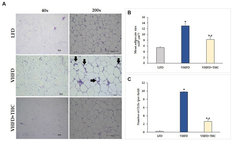 Effects of THC on histological changes of the adipose tissue: (A) H&E staining of vWATs; arrows indicate representative structures of CLSs; left column, magnification 40x; scale bar = 100 μm; right column, magnification 200x; scale bar = 100 μm; (B) mean adipocyte size; (C) number of CLSs in WATs. Data are presented as mean ± SEM. *p < 0.001 vs. LFD group; #p < 0.001 vs. VHFD group.