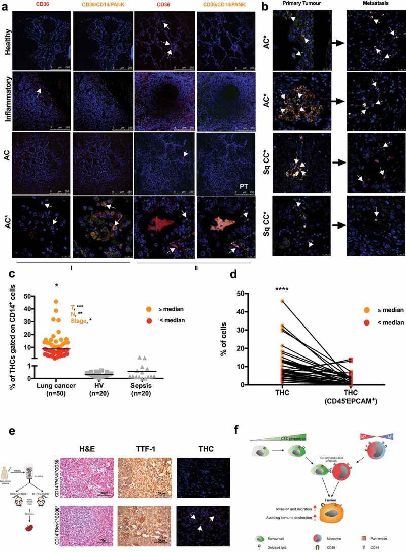 THCs specific markers signatures in patients with lung cancer.