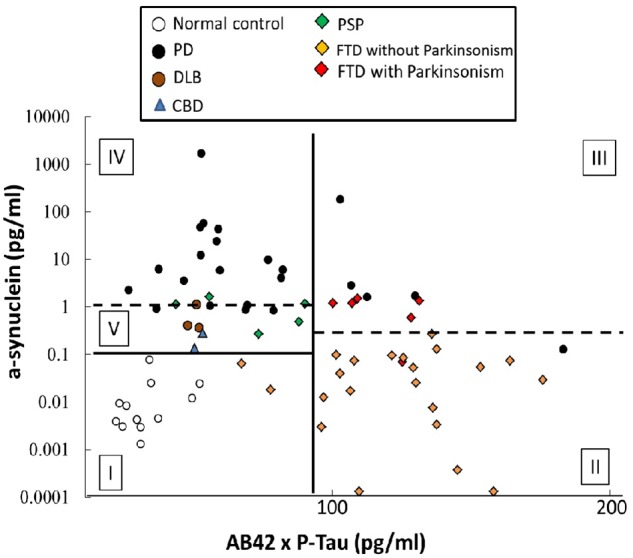 Diagnostic accuracy of plasma markers in differentiating PD and atypical parkinsonism syndromes. An ROC curve analysis was used to study the diagnostic accuracy when combining α-synuclein, p-Tau181, and Aβ42. The cut-off value of Aβ42 multiplied by p-Tau181 for discriminating patients with FTD from the parkinsonism groups (PD, DLB, PSP, and CBD) was 92.66 (pg/ml)2, resulting in 92.9 and 88.9% clinical sensitivity and specificity, respectively, and an AUC of 0.932 (vertical black line). Furthermore, among the FTD group, the cut-off value of α-synuclein was 0.1977 pg/ml for separating FTD-P from FTD without parkinsonism, for sensitivities of 88.3 and 95.5%, respectively, for FTD-P and FTD, and an AUC of 0.947 (right horizontal dashed line). In the patient groups with a value for Aβ42 multiplied by p-Tau181 of less than 92.66 (pg/ml)2, the cut-off for α-synuclein was 0.1038 pg/ml, which could differentiate patients with PD and atypical parkinsonism syndromes (DLB, PSP, and CBD) from controls (horizontal black line), with a sensitivity of 88.3% and a specificity of 95.5%; AUC = 1.00. Furthermore, 1.388 pg/ml α-synuclein could further discriminate PD from atypical parkinsonism syndromes (DLB, PSP, and CBD) with sensitivities of 73.9 and 90.0%, respectively, for PD and atypical parkinsonism syndromes (DLB, PSP, and CBD) and an AUC of 0.870 (left horizontal dashed line).