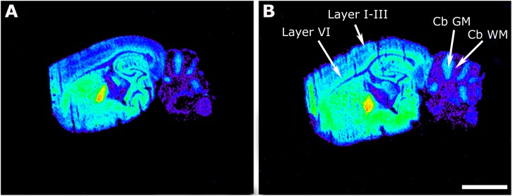 Representative autoradiograms of WT (A) and maLPA1-null mice (B) in sagittal sections that show [35S]GTPγS binding stimulated by WIN55212-2 (10– 5 M). Note the increase in the binding in maLPA1-null mice at different cortical layers (Layer I–III and Layer VI) and at the cerebellar gray matter (cb GM) and white matter (cb WM). Scale bar = 3 mm.