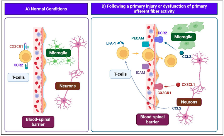 Spinal inflammation. Panel (A). Normal conditions. The intact blood–spinal cord barrier and an immunosuppressive microenvironment restrict immune activity. Panel (B). Following primary injury or dysfunction of primary afferent fiber activity. Damaged afferents release CCL2 and CX3CL1, activating glia and promoting the release of pro-inflammatory cytokines. Endothelial upregulation of ICAM-1 and PECAM-1 permits T-cell infiltration, while barrier disruption enhances immune cell entry. Neuroinflammation drives central sensitization and neuropathic pain.