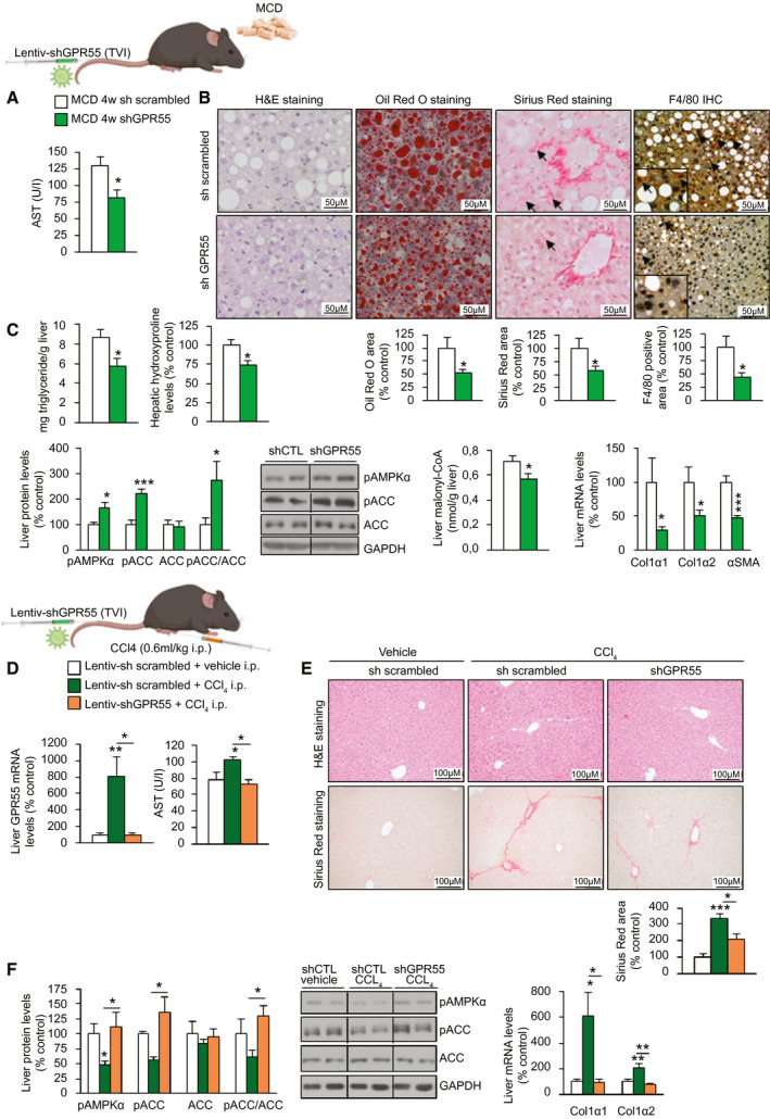 Hepatic silencing of GPR55 ameliorates NASH induced by an MCD diet and fibrosis induced by CCl4 in mice. C57BL/6J mice randomly received a TVI with Lentiv‐shGPR55 or Lentiv‐sh scrambled and 4 weeks later were fed an MCD diet for 4 weeks (n = 7). (A) Serum levels of AST. (B) H&E staining (first panel), Oil Red O staining (second panel), Sirius Red staining (third panel), and F4/80‐immunohistochemistry staining (fourth panel) of liver sections. Staining areas were quantified. (C) Triglyceride content; levels of hydroxyproline; protein levels of pAMPKα, pACC, and ACC; levels of malonyl‐CoA; and mRNA levels of fibrosis markers in the liver. C57BL/6J mice were treated with CCl4 (0.6 mL/kg administered i.p.) or vehicle once a week for 6 weeks, receiving a TVI with Lentiv‐shGPR55 or Lentiv‐sh scrambled during the first week. (D) GPR55 mRNA levels in the liver and serum levels of AST (n = 8). (E) H&E staining (upper panel) and Sirius Red staining (lower panel) of liver sections. Collagen deposition was quantified in the Sirius Red staining sections (n = 8). (F) Protein levels of pAMPKα, pACC, and ACC and mRNA levels of fibrosis markers in the liver (n = 4‐8). HPRT and GAPDH were used to normalize mRNA and protein levels, respectively. Dividing lines indicate splicing in the same gel. Data are presented as mean ± SEM. Statistical differences are denoted by *P < 0.05, **P < 0.01, and ***P < 0.001. Abbreviations: ACC, acetyl‐CoA carboxylase; AST, aspartate aminotransferase; CoA, coenzyme A; GAPDH, glyceraldehyde 3‐phosphate dehydrogenase; GPR55, G protein–coupled receptor 55; H&E, hematoxylin and eosin; HPRT, hypoxanthine‐guanine phosphoribosyltransferase; i.p., intraperitoneally; Lentiv‐shGPR55, lentiviral vector encoding short hairpin RNA against GPR55; Lentiv‐sh scrambled, lentiviral vector encoding scrambled short hairpin RNA; MCD, methionine‐choline–deficient; NASH, nonalcoholic steatohepatitis; pACC, phosphorylated ACC; pAMPKα, phosphorylated adenosine monophosphate–activated protein kinase α; shCTL, short hairpin RNA control; shGPR55, short hairpin RNA against GPR55; sh scrambled, scrambled short hairpin RNA; TVI, tail‐vein injection.