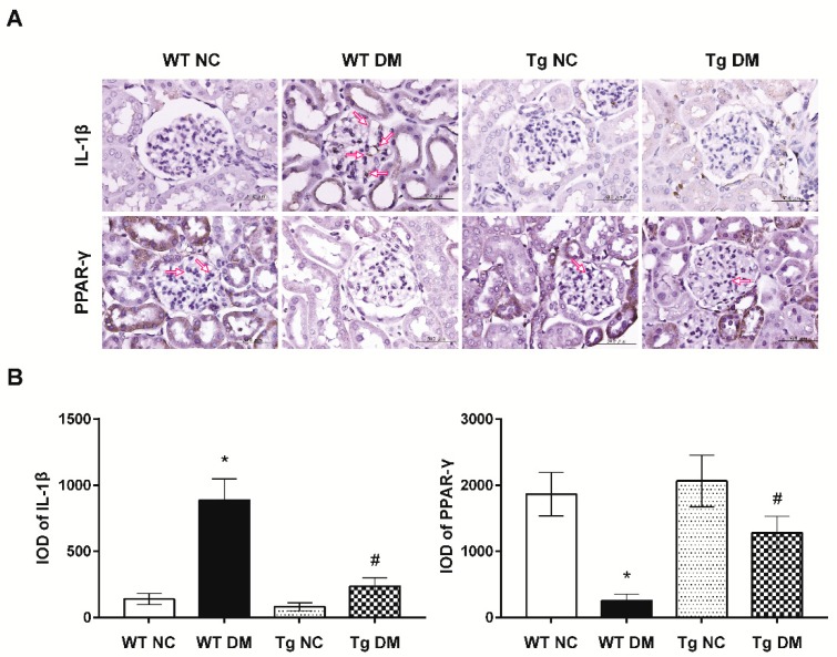 (A) Representative photographs of the immunohistochemical (IHC) staining for IL-1β and PPAR-γ in the renal cortex of study animals. Arrows indicate positive staining over mesangial cells or the mesangium. (B) The integrated optical density (IOD) of IL-1β and PPAR-γ IHC-stained materials were analyzed utilizing the Image Pro Plus software. IOD = optical intensity of positive cells × area of positive cells. Data from histomorphometric analysis are presented as means ± standard errors calculated from six independent experiments. The symbol * indicates significant difference vs. the WT NC group (p < 0.05); the symbol # indicates significant difference vs. the WT DM group (p < 0.05).