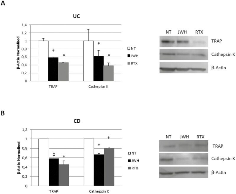 TRAP and cathepsin K protein expression in OCs from (A) 7 patients with UC and (B) 7 patients with CD after 48 hours of exposure with JWH-133 (100 nM) and RTX (5 μM). Protein levels were determined by Western blot, loading 15 μg of total lysates. The most representative images are displayed. The protein bands were detected through Image Studio Digits software. The intensity ratios of immunoblots compared to the NT, taken as 1, were quantified after normalizing with respective controls. The relative quantifications for TRAP and cathepsin K expression, normalized for the housekeeping protein β-actin, are presented in the histograms as the mean ± SD of independent experiments on each individual sample. A Student t-test was used for the statistical analysis. *P ≤ .05 compared to the NT. Abbreviations: CD, Crohn’s disease; NT, untreated control; OC, osteoclasts; RTX, Resiniferatoxin; SD, standard deviation; TRAP, tartrate-resistant acid phosphatase; UC, ulcerative colitis.