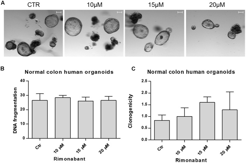 (A) Representative images of normal colon human organoids cultured in matrigel and treated for 24 h with Rimonabant or vehicle alone at the indicated doses. Scale bar = 100 μm. (B) Analysis of DNA fragmentation amount in PI-stained cells derived from normal colon human organoids, treated for 24 h with Rimonabant or vehicle alone at the indicated doses. (C) Analysis of normal colon human organoids clonogenicity after treatments with Rimonabant or vehicle alone at the indicated doses. Results represents the ratio of number of clones on day 7 vs. number of clones on day 0 (corresponding to the end of treatments). Data are expressed as mean ± SD of two independent experiments.