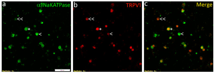 Widefield immunofluorescence images of rat cultured DRG neurons showing neurons positive for expression of α1Na+/K+ ATPase (green, (a)), TRPV1 (red, (b)), and the merged image showing co-expression (yellow, (c)). Examples of neurons showing co-expression are indicated by asterisk (*), Na+/K+ ATPase positive/TRPV1 negative are indicated by single arrowhead (<), and Na+/K+ ATPase negative/TRPV1 positive indicated by double arrowhead (<<). Scale bar in ‘a’ represents 100 µm.