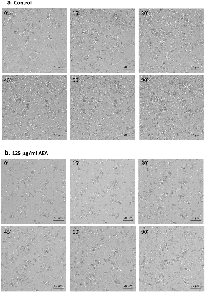 AEA inhibits hyphal growth. (a) Spinning scan microscopy of control hyphae at time 0, 15, 30, 45, 60 and 90 min. (b) Spinning scan microscopy of hyphae at time 0, 15, 30, 45, 60 and 90 min in the presence of 125 μg/ml AEA. C. albicans in yeast form was allowed to form hyphae by incubating them 4 h at 37 °C, and thereafter a time-lapse study was performed using a Nikon spinning scan microscopy in the absence (a) or presence of 125 μg/ml AEA (b). Time 0 is 30 min after adding AEA.