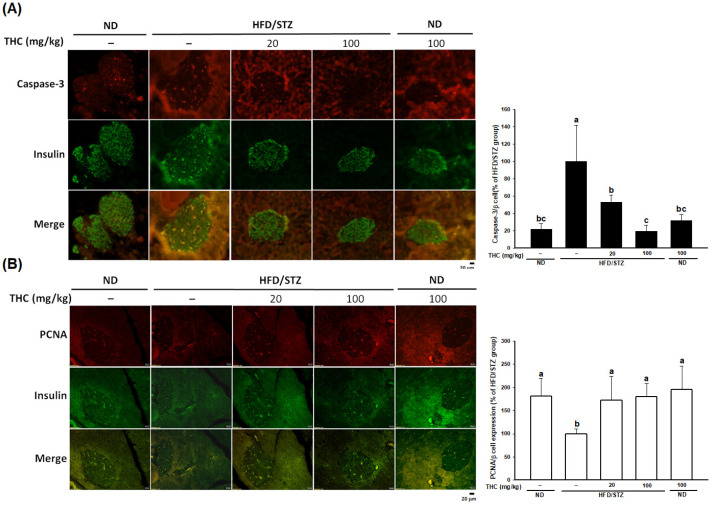 Effect of THC on β-cell apoptosis and proliferation in HFD/STZ treated mice. (A) Apoptosis of β-cell was analyzed by double immunofluorescence staining with caspase-3 (red) and insulin (green). (B) Proliferative β-cells were analyzed by double immunofluorescence staining with PCNA (red) and insulin (green). Quantification was performed by ImageJ. Data are expressed as mean ± SEM (n = 6). Statistical differences (p < 0.05) between groups were evaluated by one-way ANOVA with Tukey’s post-hoc test and were labeled as different letters (a, b, and c).