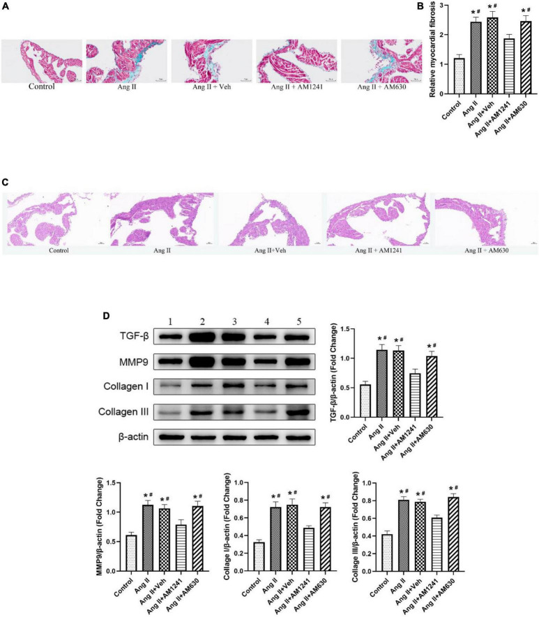 Administration of AM1241 attenuated atrial fibrosis in Ang II-infused mice. (A) Representative images of Masson’s trichrome staining. Bar = 50 μm. (B) Relative myocardial fibrosis. (C) Representative images of H&E staining. Bar = 50 μm. (D) Representative western blot image and relative expression of TGF-β, MMP9, collagen I and collagen III. Lane 1: control group; Lane 2: Ang II group; Lane 3: Ang II + Veh group; Lane 4: Ang II + AM1241 group; Lane 5: Ang II + AM630 group. The data represent the mean ± SEM. *P < 0.05 vs. control group. #P < 0.05 vs. Ang II + AM1241 group.