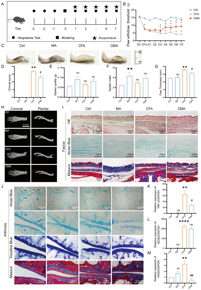 A composite image of various graphs, diagrams, and histological images related to an experiment on acupuncture and its effects on rats. Panel A shows a timeline of tests and treatments. Panel B presents a line graph of paw withdrawal threshold data over days for different groups: Ctrl, CFA, and CMA. Panels C-G depict images of rat paws and bar graphs for clinical score, spleen quality, spleen index, and paw thickness. Panel H displays X-ray images, and Panel I features histological sections stained with HE, Alcian Blue, and Masson. Panel J shows detailed views of Alcian Blue and Masson stained sections, and Panels K-M contain bar graphs of relative expression of TNF, NOG, and HAS2.