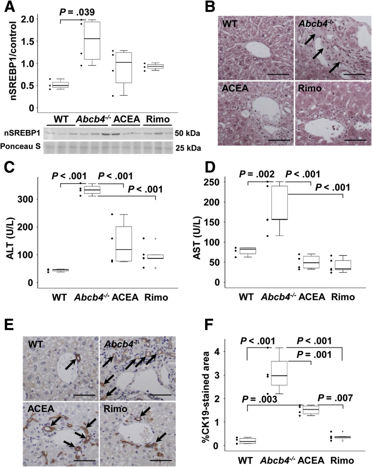 Rimonabant and ACEA reduced cholestatic liver injury in Abcb4-/-mice. (A) Nuclear SREBP (nSREBP)1 was induced in Abcb4-/- mice. Treatment with rimonabant or ACEA tendentially reduced hepatic nSREBP1. Densitometric analysis was performed with ImageJ software. n = 3–4 mice per group. Representative immunoblotting data of 3 independent experiments are shown. (B) H&E staining suggested that the cholestatic changes in the portal fields of the Abcb4-/- mice were improved by treatment with ACEA and rimonabant. Original magnification: 200×. Scale bars: 100 μm. Arrows indicate cholestasis-induced periportal alterations of hepatic architecture. (C and D) ALT and AST serum levels were induced in Abcb4-/- mice. CB1 antagonization by rimonabant but also treatment with ACEA caused a considerable reduction in serum levels of ALT and AST, indicating reduced hepatocellular injury. Serum aminotransferases were quantified in 2 independent experiments. n = 3–5 mice per group. (E and F) CK19-immunostaining (arrows) visualized enhanced ductular reaction in Abcb4-/- mice. CK19 immunostaining showed reduced ductular proliferation in ACEA- and rimonabant-treated mice. The relative area that was stained for CK19 by immunohistochemistry was quantified using ImageJ. (E) Original magnification: 200×. Scale bars: 100 μm. (A, C, D, and F) One-way analysis of variance with a post hoc Bonferroni test was used for statistical analysis. Rimo, rimonabant.