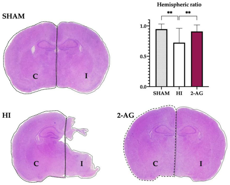 2-AG treatment helps revert the evident damage caused by HI on the ipsilateral hemisphere at P14. Representative brain slices at the level of mid-dorsal hippocampus and thalamus (Bregma −1.80 mm) of sham, non-treated HI, and 2-AG-treated animals. The graph shows the hemispheric ratios of each group at P14. Non-treated HI animals (HI) show evident damage signs in the ipsilateral hemisphere, which can also be observed in the lower hemispheric ratio values of the graph. When comparing the hemispheric ratios of HI and 2AG groups, significant differences were found (** p < 0.01). The ipsilateral hemisphere of 2-AG treated animals (2-AG) shows no signs of evident damage and hemispheric ratio values are similar to sham.