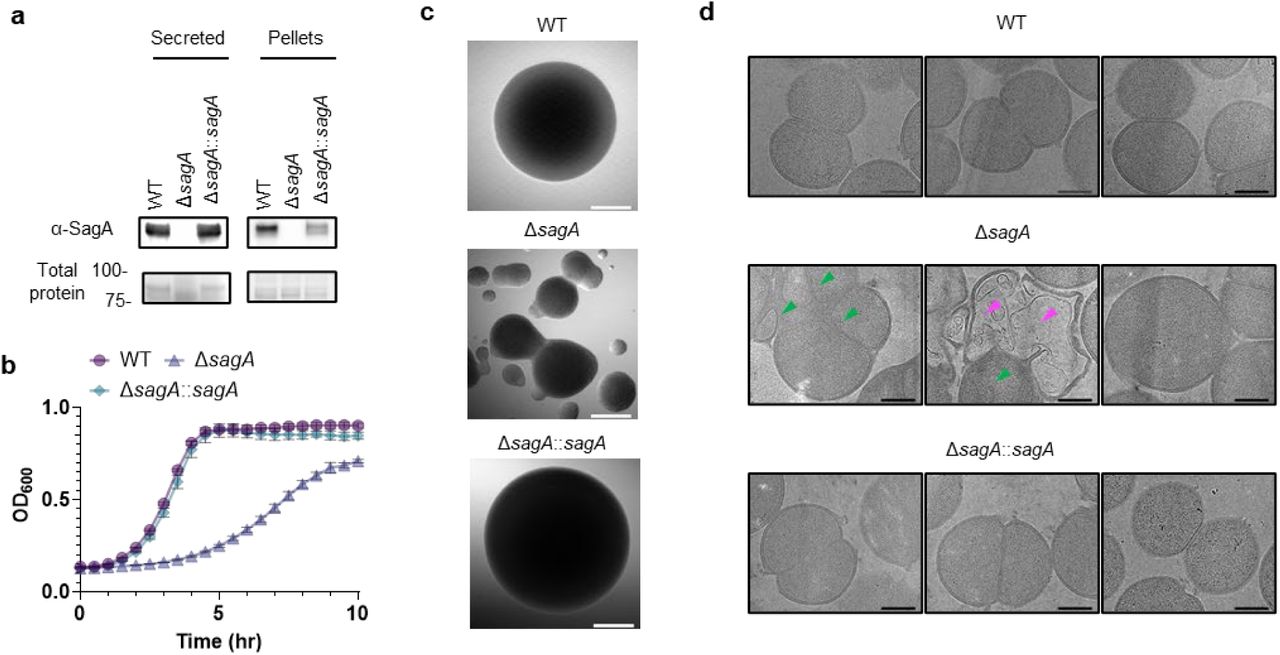 SagA is important for peptidoglycan remodeling, cell separation and growth in VREfm.a, α-SagA western blot analysis of bacterial proteins (secreted and in cell pellets) of VREfm ERV165 strains (WT, ΔsagA or ΔsagA::sagA). Stain-free imaging serves as total protein loading control. b, Growth curves of VREfm ERV165 strains in BHI. c, Representative DIC images of single colonies of VREfm strains. Scale bar, 200 µm. d, Representative low-magnification (3600×) electron microscopy images from lamellae of VREfm ERV165 strains. Dead cells are indicated with magenta arrows; defective cell divisions are marked with green arrows. Scale bars, 500 nm.