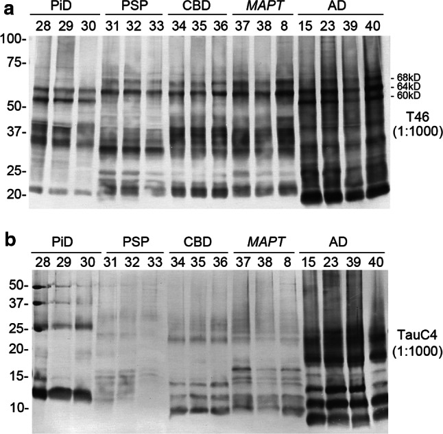 Immunoblot analyses of sarkosyl-insoluble tau and the trypsin-resistant fragments in tauopathies (additional cases). a Immunoblot analysis of sarkosyl-insoluble tau from three PiD, three CBD, three PSP, three MAPT and four AD cases. 13 additional cases (No. 28–40) were run on a gel with three cases (8, 15 and 23) analyzed in the initial study and immunoblotted with T46 antibody. b The trypsin-resistant tau from three PiD, three CBD, three PSP, three MAPT and four AD cases after the treatment of 0.1 mg/mL trypsin for 1 h were detected with TauC4 in a western blot membrane
