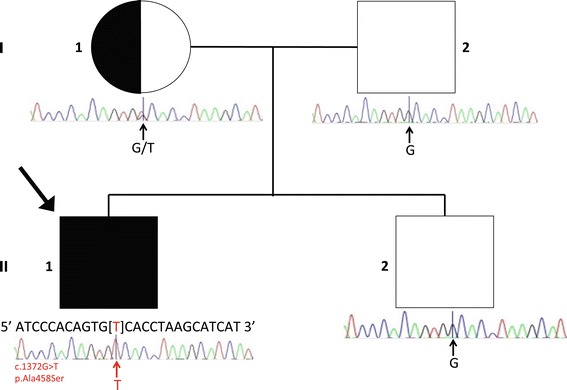 Pedigree and Sanger sequencing of a patient with FAAH2 mutation. Pedigree information for our patient and Sanger sequencing results are shown. The pedigree is consistent with X-linked recessive inheritance as the mother is clinically unaffected.