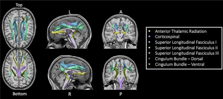 Seven TRACULA tracts assessed. Figure shows the seven reconstructed tracts from TRACULA used in the current analysis.