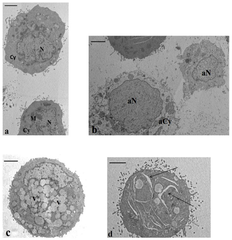 Transmission electron microscopy (TEM) sections of cultured HT-29 cells. (a) Baseline conditions. The cells showed normal nuclei (N), regular chromatin texture, and cytoplasm (Cy) containing the typical organelles’ mitochondria (M). Bar 3.5 μm. (b–d) Incubation with CB83, THC, and CBD. In all samples, a high percentage of cells with necrotic and apoptotic features was described. In (b), a necrotic cell is evidenced in an altered chromatin texture (aN) and a cytoplasm devoid of organelles (aCy) and, in (c), is represented in an apoptotic cell with a cytoplasm rich in vacuoles (V). The cell showed in (d) highlights enlargements in the cytoplasm (arrows). This feature was detected in a percentage of 8–12% in all treated samples. (b,d) Bar 3.5 μm. (c) Bar 3 μm.