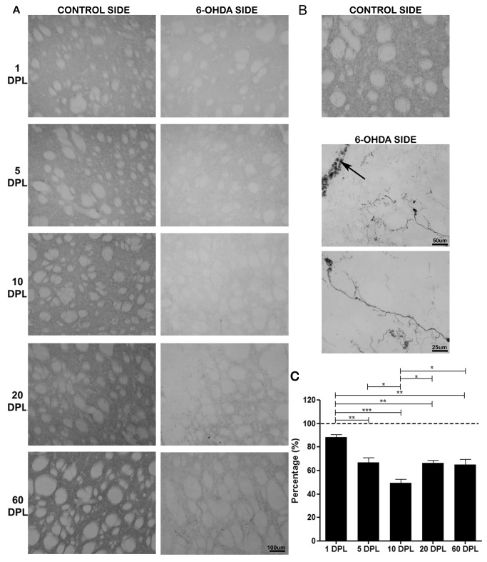 Temporal changes of TH levels in the striatum of PD-induced rats.TH levels in striatum of rats submitted to unilateral intrastriatal injections of 6-OHDA after 1, 5, 10, 20, and 60 days post-lesion (DPL). (A) Digital images of coronal sections of the dorsolateral striatum shows a decrease in the expression of TH on the 6-OHDA side, with a peak in 10 DPL (B) Digital images of coronal sections of the dorsolateral striatum at 60 DPL; the arrow indicates the site of infusion. Note the emergence of TH+ cells in the experimental side. (C) Semi-quantitative analysis of TH staining represented as percentage. Control side (dashed line). Statistical analysis by ANOVA (one way) with Tukey post-test. * p <0.05, ** p <0.01 and *** p <0.001.
