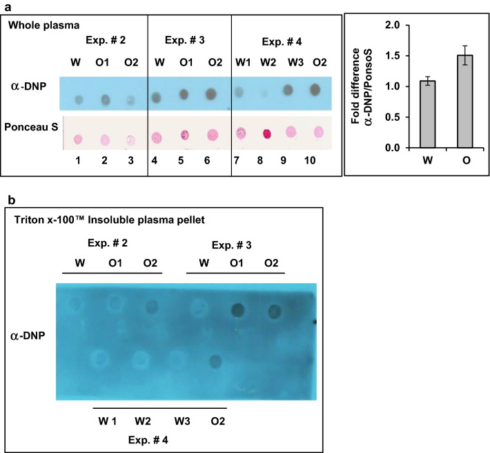 Chronic oxycodone treatment increases protein carbonyl content in rat plasma. a Dot-blot analysis of carbonylated proteins in rat plasma. Left panel, equal amount of total protein from plasma of rats treated with oxycodone (O1, O2) or water (W) were derivatized with DNPH, spotted on NC membrane and probed with anti-DNP antibodies. The same membrane was later stained with Ponceau S to detect total protein in each spot. Each plasma sample corresponds to the same animal from which cortex samples was obtained (Fig. 1a, Exp. #). The corresponding experiment is indicated above each set of samples. Right graph, quantitative analysis of dot-blot images shown on left. DNP signal was normalized to Ponceau S signal in corresponding sample and then oxycodone value was normalized to water value in the same experiment. Graph represents mean value of DNP to Ponceau S ratio normalized to water samples set as one (± SEM; n = 3 (three sets of experiments that analyzed samples from 9 water and 13 oxycodone treated rats; p = 0.1). b Dot-blot analysis of Triton™ X-100 insoluble carbonylated proteins in rat plasma. Equal volume of plasma samples from rats treated with water (W) or oxycodone (O) corresponding to samples presented in a was centrifuged at 20,000×g for 30 min. The pellets were resuspended in buffer containing 1% Triton™ X-100 and centrifuged again. Resulting pellets were dissolved in buffer, derivatized with DNPH, spotted on NC membrane and probed with anti-DNP antibodies