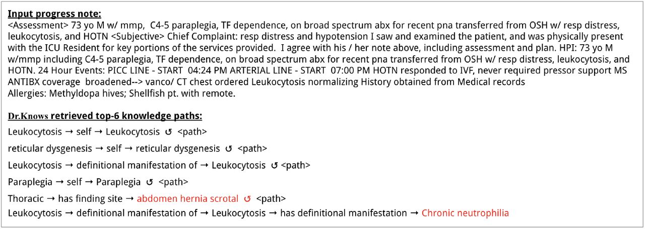 An error example of Dr.Knows retrieved knowledge pathways. Dr.Knows finds two paths leading to irrelevant and misleading diagnosis, marked as red fonts. The ↺ symbol represents a self-loop.