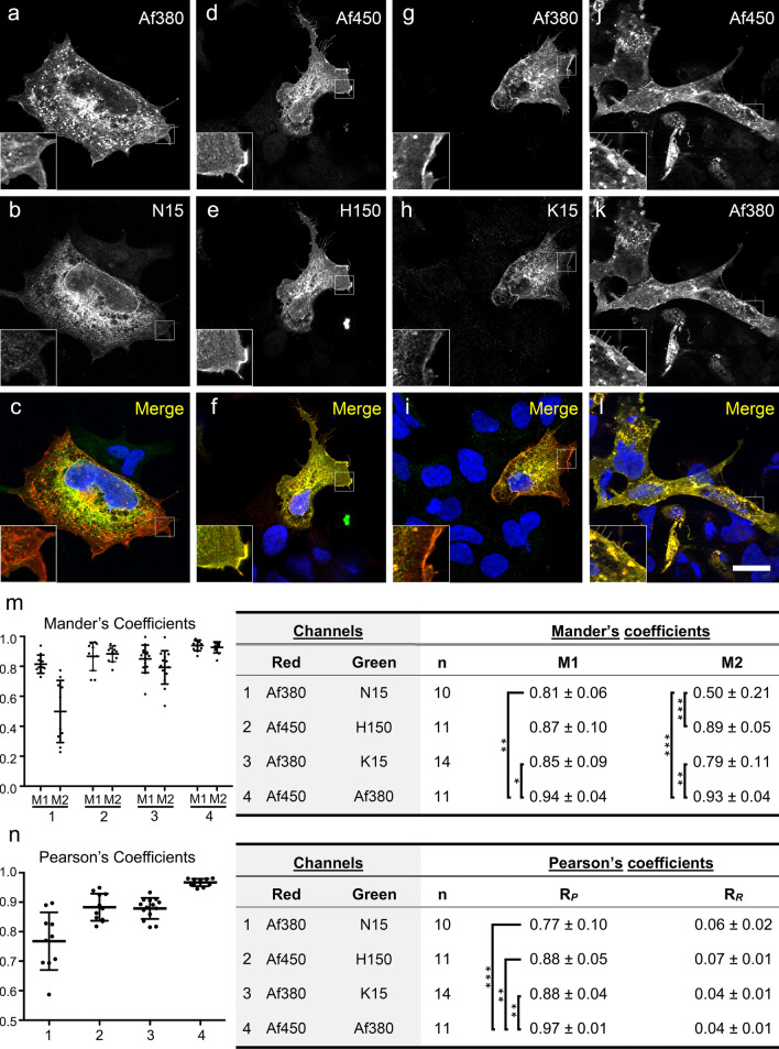 Double immunofluorescence labelling of CB1-transfected HEK293 cells (a–l) with combined goat and rabbit anti-CB1 receptor antibody couples: Af380/N15 (a–c), Af450/ H150 (d–f), Af380/K15 (g–i) and Af450/Af380 (j–l). Single-channel images shown in a, d, g, j and in b, e, h, i were pseudocoloured red and green, respectively, and together with Hoechst’s chromatin staining to generate images shown in c, f, i, l. Scale bar: 20 µm (applies to a–l). Micrographs are maximum intensity projections of three consecutive optical sections separated by 0.24 μm, obtained by structured illumination microscopy (m–n). Measurement of the Mander’s pixel overlap M1 and M2 and Pearson’s RP pixel intensity correlation coefficients between the two immunofluorescence signals of doubly immunostained cells. Graphs in m–n show plots and mean ± SD values of the Mander’s and Pearson’s coefficients. Kruskal–Wallis ANOVA yielded statistically significant differences between groups for M1 (P < 0.005) and M2 coefficients (P < 0.0001) and RP (P < 0.0001) values. Asterisks in tables refer to significant differences from Dunn’s multiple comparison test (*P < 0.05; **P < 0.01; ***P < 0.001)