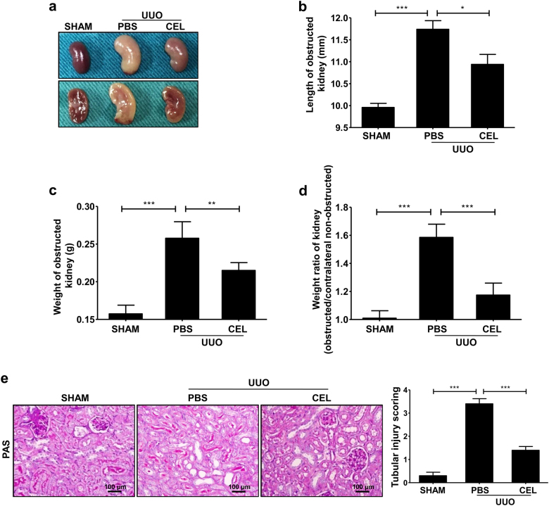 Celastrol improves UUO-induced renal injury.The mice received celastrol (1 mg/kg) daily for 7 days from the day of surgery. The vehicle-treated mice were treated with an equal volume of PBS, and the sham group was used as the control for UUO. Kidney tissues were collected 7 days after UUO. a The gross-morphological images of kidney tissue from each group mice. b Length and c weight of the obstructed kidney, and d weight ratio of the kidney (obstructed/contralateral non-obstructed kidney) from each group mice were measured. e Representative micrographs show kidney tubular injury determined using PAS staining and quantification of tubular injury scoring of kidneys in different groups of mice. All values are represented as mean ± SEM. Scale bar = 100 μm. n = 5/group. *P < 0.05, **P < 0.01, and ***P < 0.001