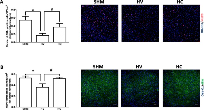 Quantification of mature oligodendrocyte population and myelin staining in cerebral cortex. Representative microphotographs and graphical representation of immunohistochemical studies performed in the parieto-occipital cortex 30 days after a hypoxic-ischemic (HI) insult induced in P7–10 Wistar rats then receiving vehicle (HV) or cannabidiol (HC), or a similar period in control rats (SHM). (A) GST-π (mature oligodendrocyte) and (B) myelin basic protein (MBP) staining. Bars represent mean ± SEM. Scale bar: 50 μm. *p < 0.05 vs SHM; # p < 0.05 vs HV), by ANOVA.