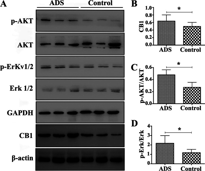 Expression of the CB1, AKT, p-AKT, Erk1/2 and p-Erk1/2 proteins in JZSMCs. a Characteristic blots for each protein. b Comparison of intercellular CB1 protein expression in each group. c Comparison of the intercellular p-AKT/AKT ratios. d Comparison of the intercellular p-Erk/Erk ratios. Three independent experiments were conducted for each treatment, and one representative image from each group of three experiments is shown. The error bars on all histograms indicate the standard deviation. *, P < 0.05