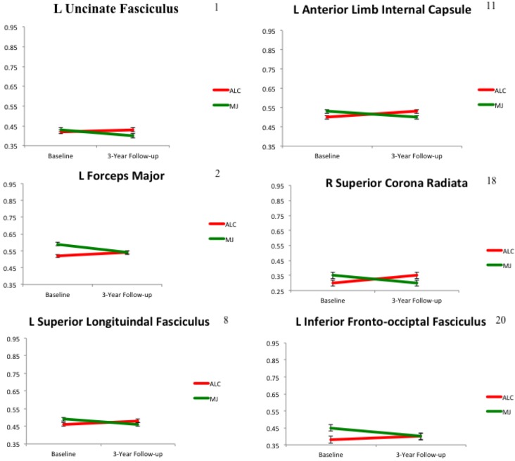 Group by time interactions for WM integrity showing increasing FA in ALC and decreasing FA in MJ (n = 16, p < 0.01); numbers correspond to cluster order.