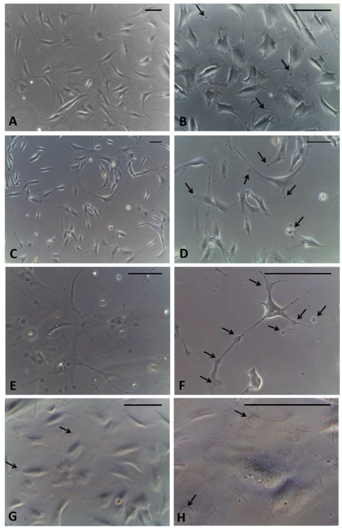 Fibroblasts derived from human hip fascia and seeded in 24-multiwells: control cells (A); cells treated with HU-308 2.5 µM for 1 h (B), 2.5 h (C,D), 4 h (E,F), and 6 h (G,H). Arrows: vesicles produced by fascial cells. Scale bars: 50 μm.