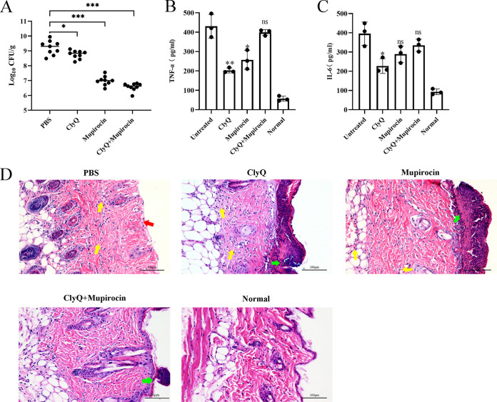 The combination of ClyQ and mupirocin could effectively treat S. aureus-induced skin infection. The four groups of mice were treated with ClyQ, mupirocin, and a combination of ClyQ and mupirocin, respectively, at 20, 23, 26, 36, 39, and 42 h after infection. (A) The bacterial burden of skin tissue was determined at 43 h postinfection. (B and C) Levels of inflammatory cytokines TNF-α (B) and IL-6 (C) in the skin of mice were measured. (D) Hematoxylin and eosin staining of skin samples was observed by microscopic examination (magnification, ×200).