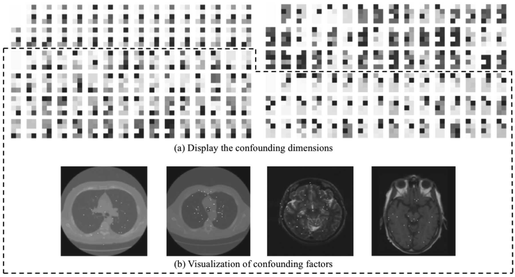 (a) Display of trained weights and (b) the visualization of confounding factors.