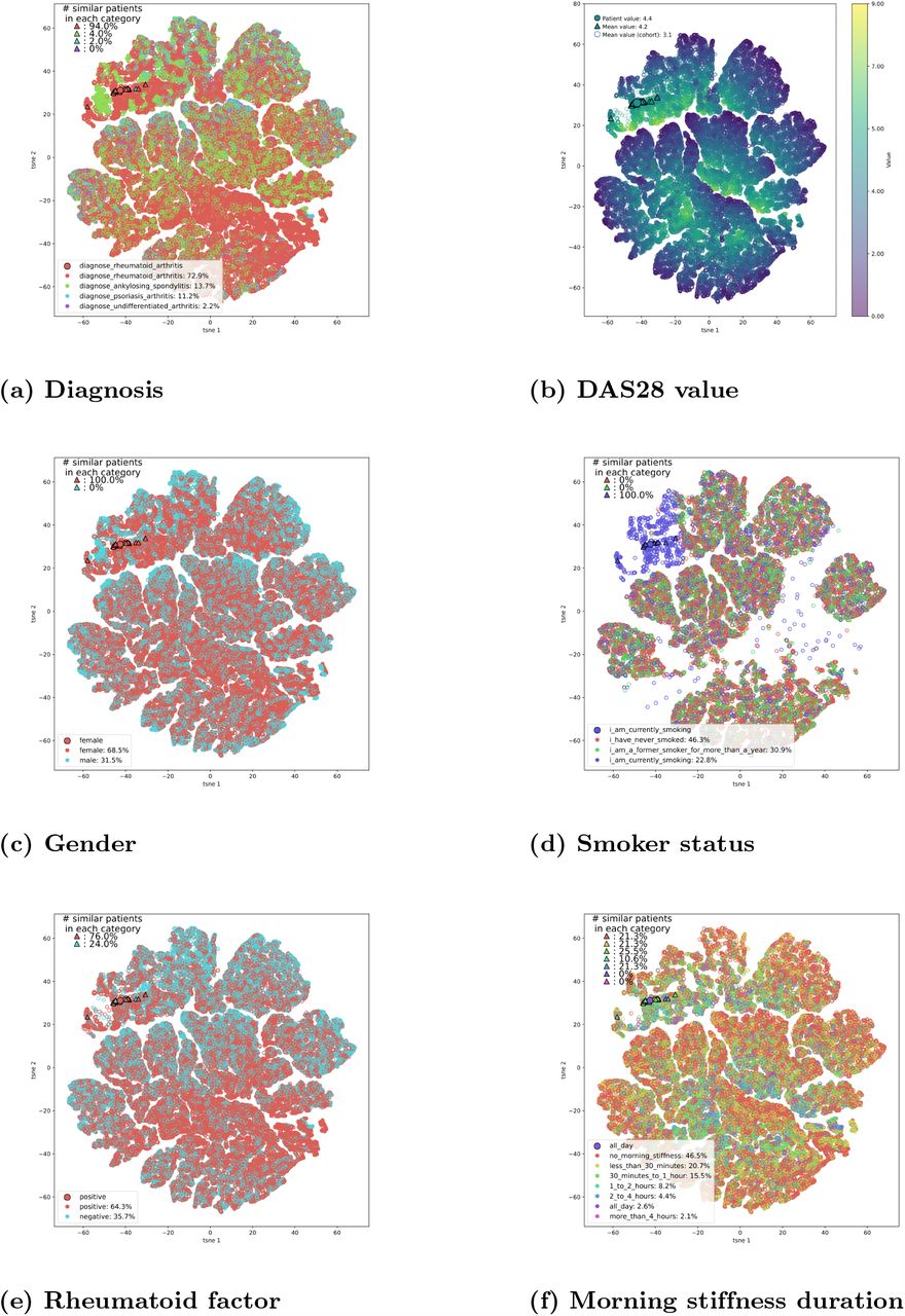 t-SNE visualisation of patient representations.Each point shows the t-SNE embedding of a representation of a patient at a given time. The subplots show the decomposition overlaid with the feature values (restricted to the embeddings with an available value for the feature). Furthermore, we highlighted a patient from the test set (larger filled dot) and her nearest neighbours (triangles) as computed by our algorithm. For each continuous feature we compute the average value in the entire cohort and within the subset of nearest neighbours. For categorical features, we computed the proportion of each category.