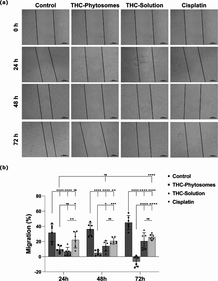 Wound closure rate evaluation of the different proposed treatments. (a) Photomicrographs of the scratch lines exposed to THC-phytosomes, THC-solution, and cisplatin at different timelines (24 h, 48 h, and 72 h) taking untreated oral cancerous cells as the negative control. The scratch line is the widest in the phytosomes-treated group at all time points, showing a significantly decreased migration rate percentage compared to the other proposed treatments. (b) A scatter plot with a bar graph representation of the migration percentage of SCC4 cells, where two-way ANOVA followed by Tukey’s multiple comparisons test reveals * of p < 0.05, ** = p < 0.01, *** = p < 0.001, and **** = p < 0.0001, while ns (non-significant) = p > 0.05. The data is mean ± SD of triplicates (each is a well of a 6-well plate seeded with 25 × 104 SCC4 cells)