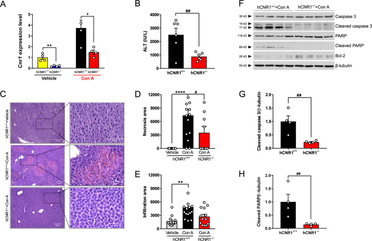 Nullification of hepatic CB1R ameliorates liver damage via anti-apoptotic signaling.A Cnr1 in liver from hCNR1+/+ and hCNR1−/− mice with or without Con A (5 mg/kg) injection (n = 4–5) for 12 h. B Plasma alanine aminotransferase (ALT) levels (IU/L) in Con A-administered hCNR1+/+ and hCNR1−/− mice (n = 6 per each group). C–E H&E staining (×10 (left, scale bars, 200 μm) and ×40 (right, scale bars, 100 μm) magnifications) and quantifications of the percentage of the average area of inflammatory cells inflammation (D) and hepatocyte necrosis (E) after 5 mg/kg of Con A administration for 12 h. F Protein expression levels in liver tissue lysates post-injection of 5 mg/kg of Con A administration for 12 h (n = 4) and quantification for cleaved caspase 3 (G) and poly (ADP-ribose) polymerase (PARP) (H). Values were normalized to β-tubulin. Results were expressed as mean ± S.E.M. (*p ≤ 0.05, **p ≤ 0.01, ****p ≤ 0.0001 compared to Control; #p ≤ 0.05, ##p ≤ 0.01, ###p ≤ 0.001 compared to hCNR1+/++Con A).