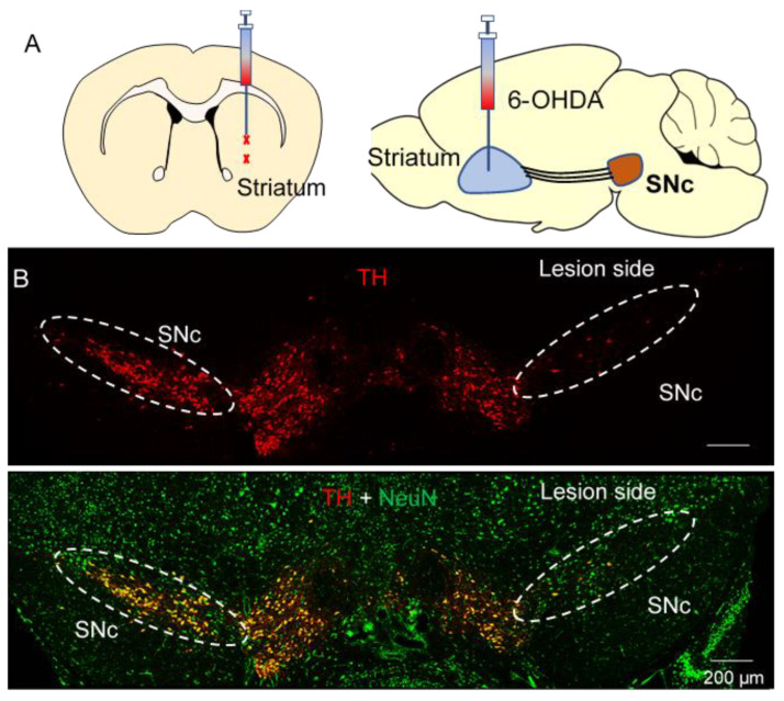 6-OHDA induced selective degeneration of SNc dopamine neurons. (A) Diagram showing the two targeted 6-OHDA injection sites in the striatum, where it is taken up by SNc axonal terminals. (B) Immunohistochemistry for TH in the SNc and neighboring VTA of mice that received unilateral injections of 6-OHDA (top). Immunohistochemistry for TH overlaid with NeuN shows the selectivity of 6-OHDA for dopamine neurons (bottom), n = 3 mice.