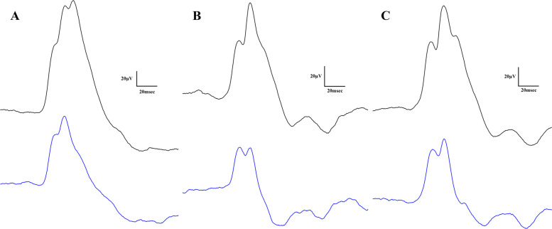 Representative light-adapted electroretinographical waveforms (blue line for 3000 and black line for 10000 mcd·s/m2 light stimuli). A Lean, B ZDF, C ZDF + CBD group
