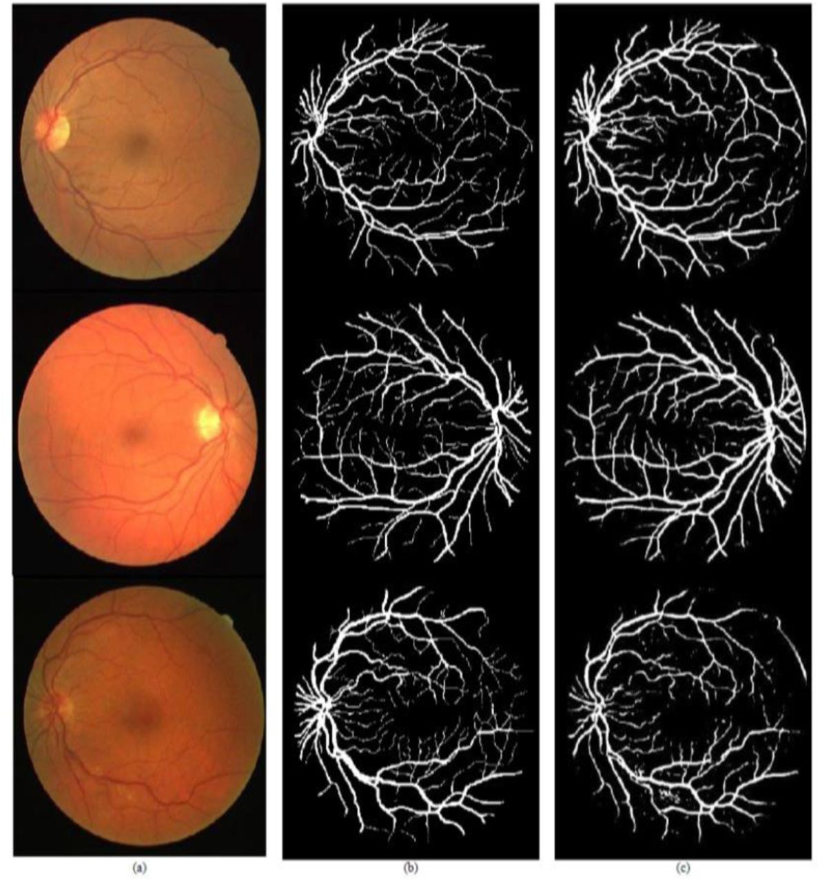 Detection of retinal vessel using CNN a) Original images b) corresponding ground truth and c) detection results.