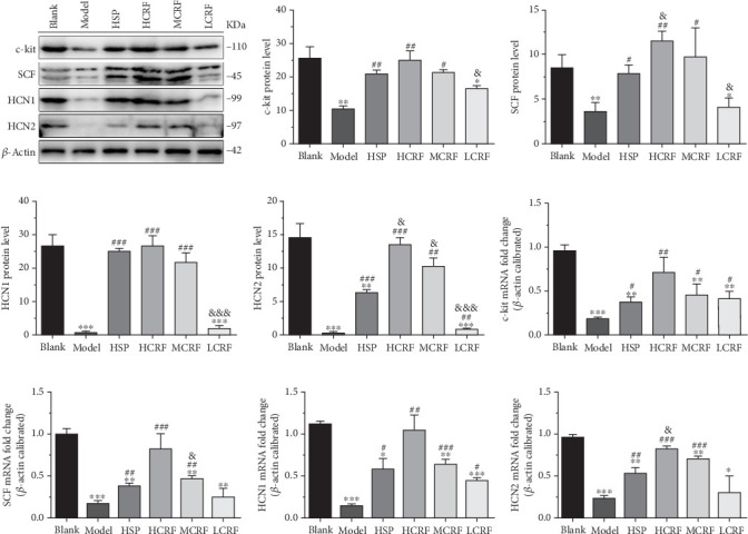 The expressions of c-kit, SCF, HCN1, and HCN2 mRNA and protein in the descending colon of rats. (a) The protein levels of c-kit, SCF, HCN1, and HCN2 in the descending colon of rats were detected by western blotting. The relative quantitative histogram of (b) c-kit, (c) SCF, (d) HCN1, and (e) HCN2 protein levels in the descending colon of rats. The mRNA levels of (f) c-kit, (j) SCF, (h) HCN1, and (i) HCN2 in the descending colon of rats were detected by RT-PCR. HSP: hemp seed pill group; HCRF: high-dose CRF group; MCRF: medium-dose CRF group; LCRF: low-dose CRF group. ⁣∗p < 0.05, ⁣∗∗p < 0.01, ⁣∗∗∗p < 0.001 vs. blank; #p < 0.05, ##p < 0.01, ###p < 0.001 vs. model; and &p < 0.05, &&p < 0.01, &&&p < 0.001 vs. HSP.