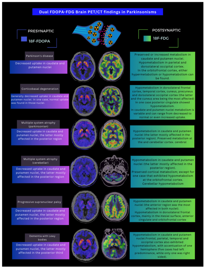 Representative findings of brain dual PET-CT in patients with different Parkinsonisms.