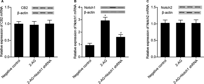 (A) Notch1 shRNA and 2‐AG had no effect on CB2 expression. (B) Notch 1 level in 2‐AG and 2‐AG + Notch1 shRNA groups was much higher than that in the NC group, and Notch 1 level in 2‐AG group was even higher than that in the 2‐AG + Notch1 shRNA group (*P value <.05 vs negative control group; #P value <.05 vs. 2‐AG group). (C) Notch1 shRNA and 2‐AG had no effect on Notch 2 expression