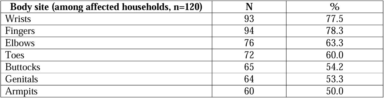 Body sites affected among scabies-affected households (n=120)
