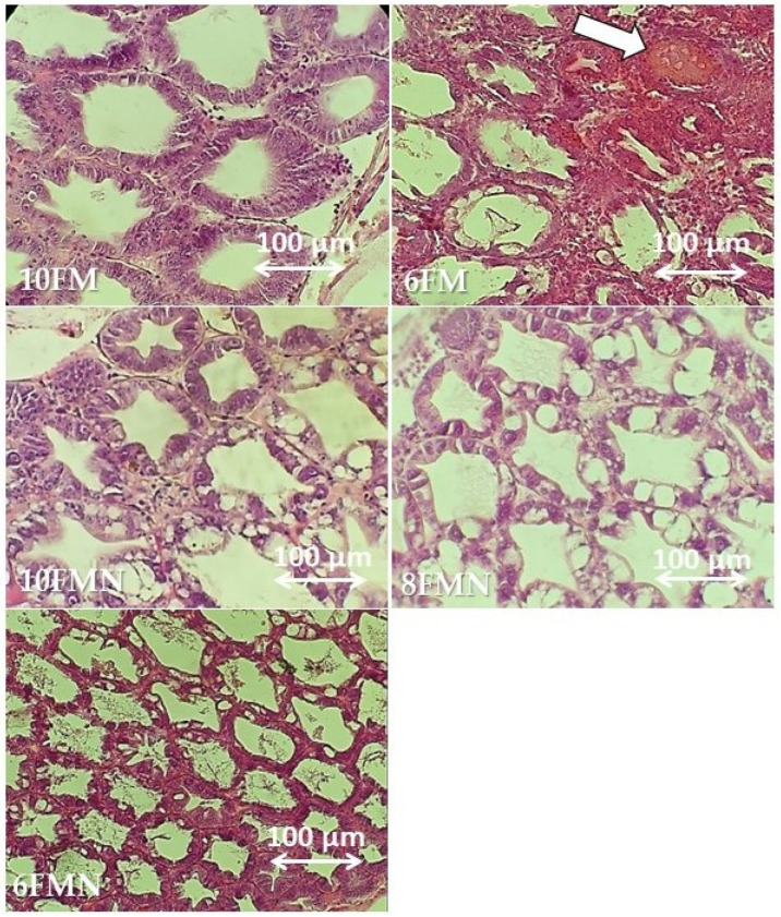 Representative histopathological images of hematoxylin and eosin-stained sections of the hepatopancreas from Pacific white shrimp (PWS) belonging to different study groups. 10FM (control group; 10% FM), 6FM (6% FM and no nucleotide supplementation), 10FMN (10% FM; 0.1% nucleotides), 8FMN (8% FM; 0.1% nucleotides) and 6FMN (6% FM; 0.1% nucleotides). The white arrow points to vacuolation observed in the 6FM group as a result of replacing fish meal with vegetable protein sources.