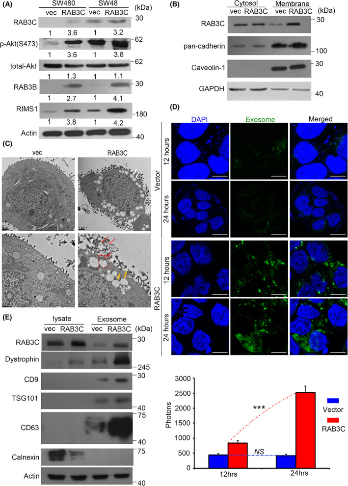 RAB3C regulates signaling transduction, vesicle formation, and exocytosis. (A) Western blots showing the RAB3C, total‐/phosphor‐Akt, RAB3B, and RIMS1 in the RAB3C‐overexpression models. (B) Intracellular expression of RAB3C in CRC cells after definition of cytoplasm/cell membrane. (C) Representative images of RAB3C‐expression model in SW480 cells examined by transmission electron microscopy (TEM). White arrows indicate exocy.tosis; yellow and red arrows indicate ILVs and MVBs, respectively. ILVs: intraluminal vesicles; MVBs: multivesicular bodies. Scale bar: 1 and 0.5 μm, respectively. Red arrows indicate exosomes. (D) (upper) Representative images and (lower) quantification of exosomes between vector and RAB3C‐overexpression models in SW480 cells examined by confocal microscopy. Analysis represents exosomal membranes. Blue: DAPI. Green: exosome membrane. Scale bar: 25 μm. (E) Western blot analysis of expressions of RAB3C, calnexin, dystrophin, CD9, CD63, and TSG101 of whole cells and exosomes isolated in RAB3C‐expression models. ***P < 0.001, NS, not significant. Data are presented as the mean ± standard error of the mean. Student's t‐test was used for the comparison of measurable variants of two groups. All experiments were performed with at least three biological duplicates (n = 3) for each group, in triplicate.