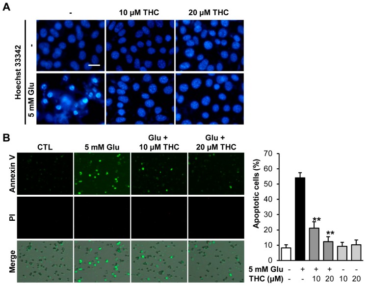 THC blocked glutamate-induced apoptotic cell death in HT22 cells. (A) Cells were treated with 5 mM glutamate with or without 10 or 20 μM THC for 12 h and stained with Hoechst 33342. (B) We also performed Tali-image based analysis to identify the percentage of apoptotic cells. Merged images (bottom) were combined with bright field (gray; not shown), annexin V (green; top), propidium iodide (red; middle) images. The bars denote the percentages apoptotic cells determined by annexin V-positive cells (** p < 0.001 compared to glutamate-treated cells).