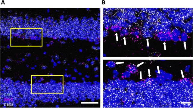 Dagla is expressed in neural stem and progenitor cells (NSPCs). (A) Representative image of an RNAscope in situ hybridisation assay detecting transcripts of diacylglycerol lipase alpha Dagla (white) and neural progenitor marker Sox 2 (magenta) in the dentate gyrus of hippocampus (DG) (scale bar 50 µm). (B) The magnified insets (scale bar 10 µm) show the subgranular zone (SGZ); the progenitor layer in the DG. White arrows indicate Sox 2-positive cells that co-express Dagla (scale bar 10 µm).